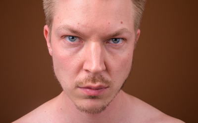 Резким покраснением кожи, особенно лица - Квинмед